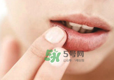 你的嘴唇為什么起泡 嘴唇上的水泡治不好嗎？