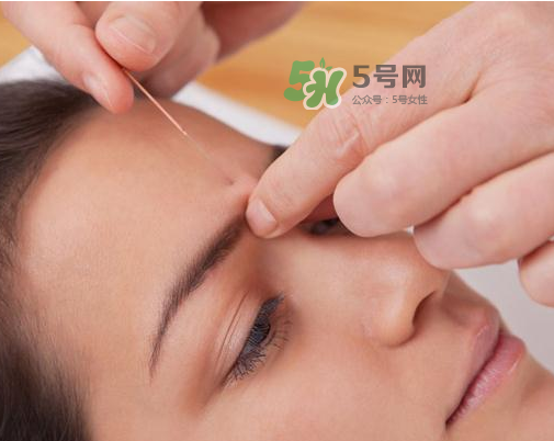 三伏天針灸有什么好處？三伏天針灸注意什么？