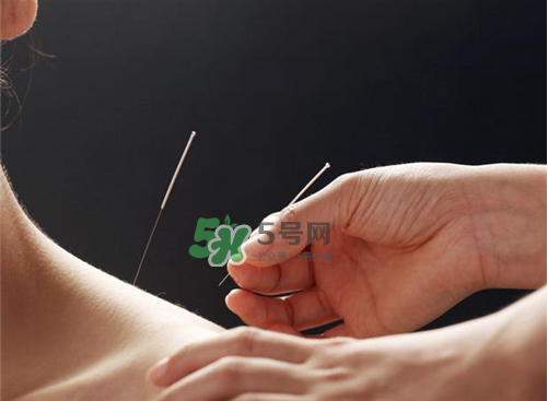 三伏天針灸有什么好處？三伏天針灸注意什么？