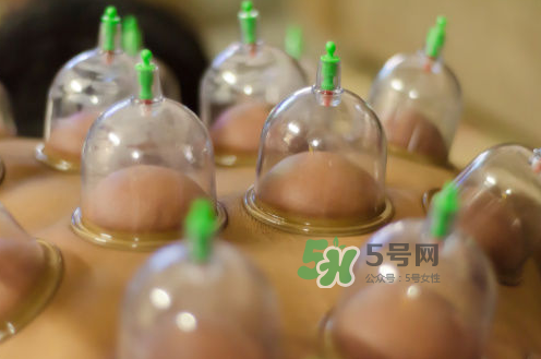 拔火罐是夏天好還是冬天好？什么時(shí)候拔火罐最合適？