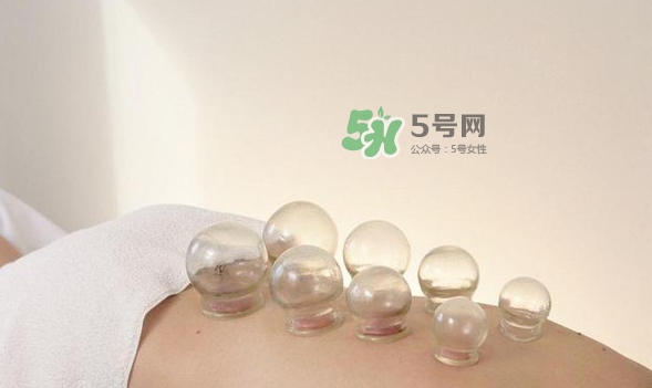 拔火罐是夏天好還是冬天好？什么時(shí)候拔火罐最合適？