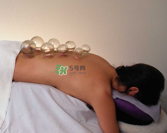拔火罐一次多長時間？拔火罐一般多長時間？