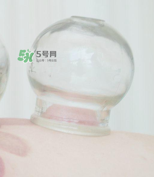 拔火罐一次多長時間？拔火罐一般多長時間？