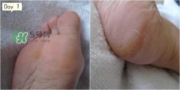 baby foot足膜怎么用？baby foot足膜使用方法