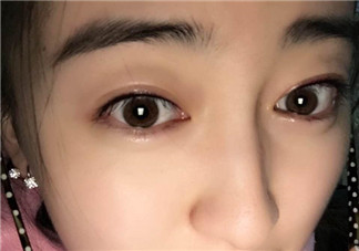 做美瞳線會不會掉睫毛？做美瞳線掉睫毛怎么辦？
