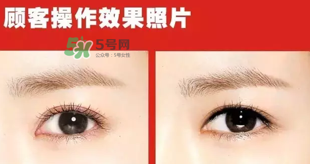 美瞳線有必要做嗎？做美瞳線多少錢？