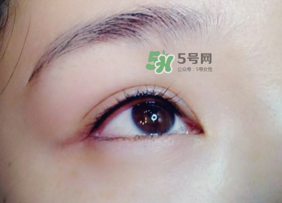 做美瞳線疼嗎？做美瞳線后要注意什么？
