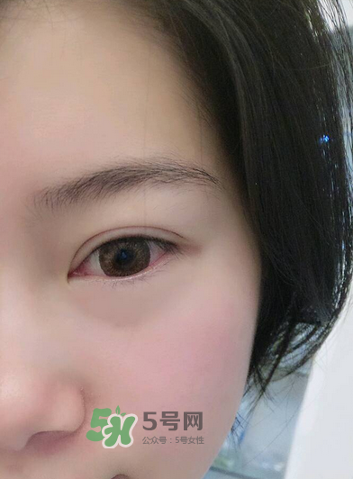 做美瞳線疼嗎？做美瞳線后要注意什么？