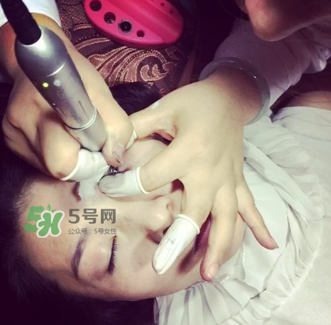 做美瞳線要打麻藥嗎？做美瞳線麻藥怎么敷？