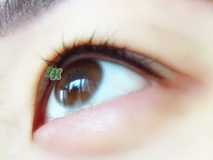 做美瞳線麻藥進眼睛怎么辦？做美瞳線麻藥灼傷眼睛怎么辦？