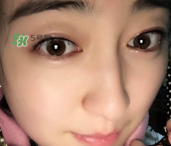 做美瞳線可以喝酒嗎？做美瞳線喝酒有影響嗎？