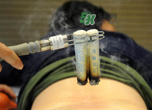三伏天艾灸后能吹空調(diào)嗎？三伏天艾灸后能吹電扇嗎？
