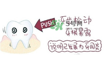 牙齒松動(dòng)會(huì)自己好嗎？牙齒松動(dòng)會(huì)自己掉嗎
