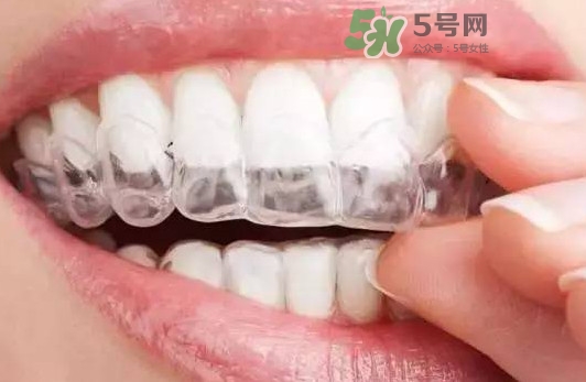 牙齒有縫隙可以補(bǔ)嗎？牙齒縫隙大能補(bǔ)嗎