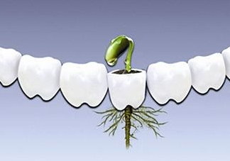 種植牙多少錢(qián)一顆？為什么種植牙很貴