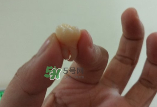 拔智齒痛嗎？智齒拔了多久洞會好？
