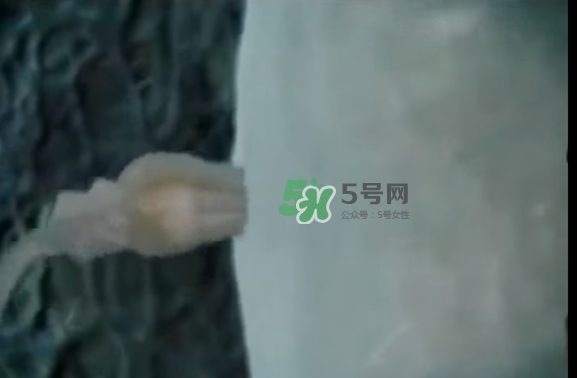懷孕初期怎么保胎？陰道出血是流產(chǎn)征兆嗎？