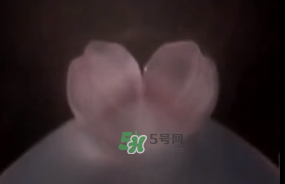 懷孕初期怎么保胎？陰道出血是流產(chǎn)征兆嗎？