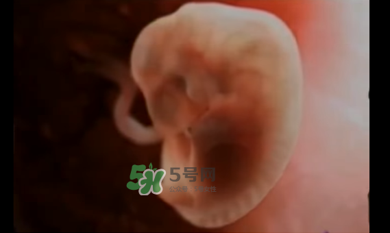 懷孕初期怎么保胎？陰道出血是流產(chǎn)征兆嗎？