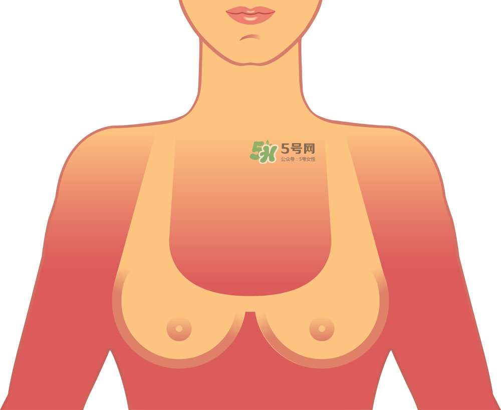 女性乳頭癢是怎么回事？女性乳頭癢要怎么治療？