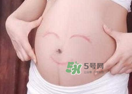 產(chǎn)婦胃脹氣怎么緩解？產(chǎn)婦胃脹氣怎么辦？