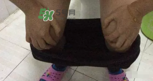 孕期可以蹲著上廁所嗎？孕期上廁所會壓到寶寶嗎？