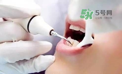 孕婦能矯正牙齒嗎？懷孕期間可以矯正牙齒嗎？
