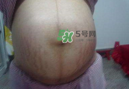 懷女孩肚子上會(huì)長(zhǎng)毛嗎？懷女孩肚子特征圖片