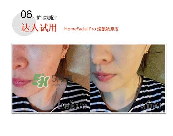 homefacialpro煙酰胺原液怎么樣？hfp煙酰胺原液好用嗎