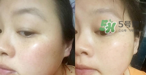 可思美潔面儀好不好用？可思美凈致潔顏聲波潔面儀怎么樣？