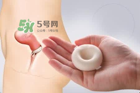 殺精劑有什么副作用？殺精劑的使用方法