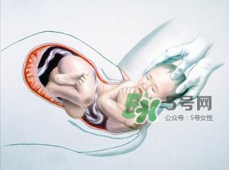 順產(chǎn)和剖腹產(chǎn)哪個(gè)好？順產(chǎn)和剖腹產(chǎn)哪個(gè)痛？