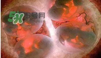多胞胎是怎么生產(chǎn)的？多胞胎應(yīng)選擇什么分娩方式