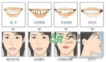 乳牙齲齒要不要補(bǔ)？乳牙齲齒怎么辦？