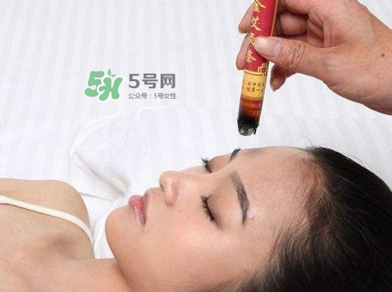 艾灸會不會過敏？艾灸過敏怎么辦