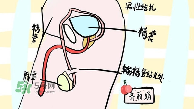 生完二胎一定要結(jié)扎嗎？生完二胎結(jié)扎好不好？