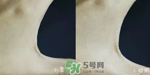小黑瓶和小棕瓶可以一起用嗎？小棕瓶和小黑瓶哪個先用