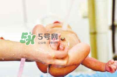 羊水栓塞是醫(yī)療事故嗎？羊水栓塞多發(fā)生于順產(chǎn)還是剖腹產(chǎn)？
