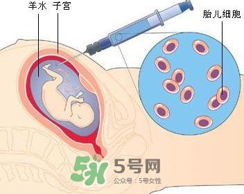 羊水栓塞是怎么回事？羊水栓塞怎么預防？