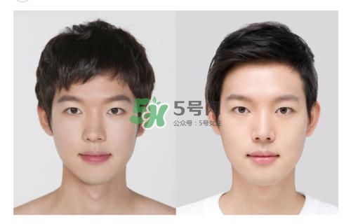 美白針有副作用嗎？美白針有什么副作用？