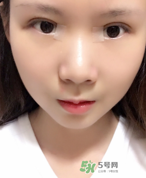 美皮護去疤效果怎么樣？美皮護有用嗎？