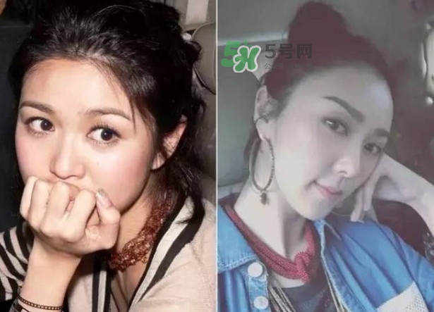 發(fā)際線低怎么調整？標準的發(fā)際線圖片