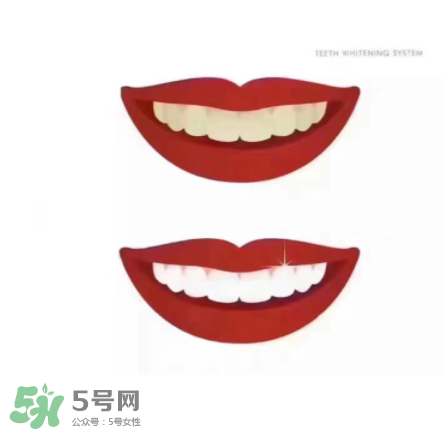 美牙儀能帶上飛機(jī)嗎？美牙儀可以過安檢嗎？