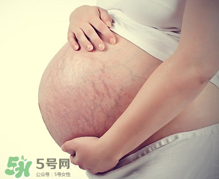 孕婦胸部長(zhǎng)妊娠紋嗎？胸部長(zhǎng)妊娠紋了怎么辦？