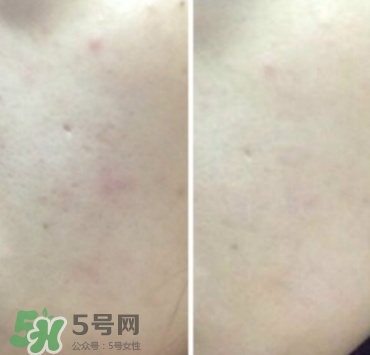 美康粉黛氣墊bb怎么樣？美康粉黛氣墊bb毀容
