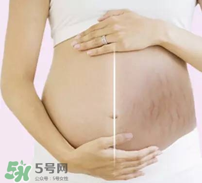 長妊娠紋的前兆 長妊娠紋很癢怎么辦？