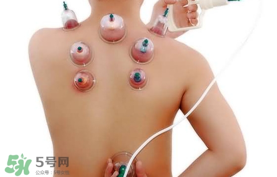 火罐和真空罐哪個(gè)好？真空罐和火罐效果一樣好嗎