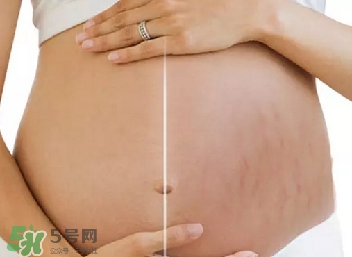 脖子上會長妊娠紋嗎？妊娠紋長在哪些地方？