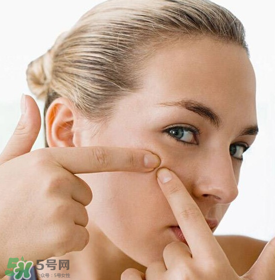 長痘長閉口怎么辦？長痘長閉口是什么原因？