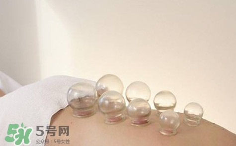 真空拔罐有用嗎？真空拔罐多長(zhǎng)時(shí)間合適